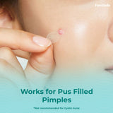 healing pimble patch best feminine hygiene brands in India