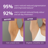 FemiSafe Underarm Roll-On with 3% AHA BHA | 50ml