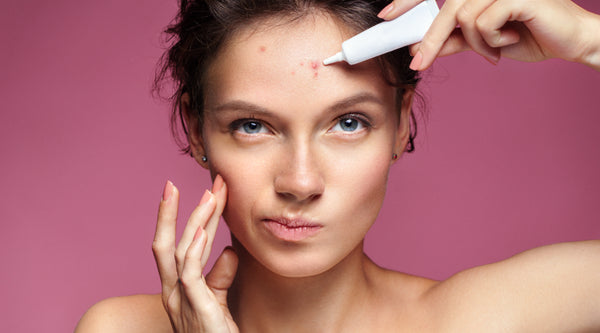 Unmasking the Truth: Decoding Forehead Acne and Clearing the Confusion