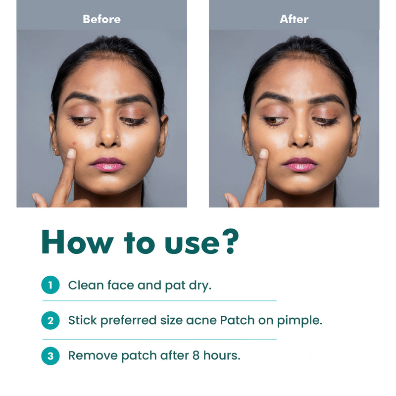 How to use, clean face and pat dry, stick preferred size acne pimple patch, remove patch after 8 hours