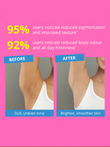 Underarm Roll-On with 3% AHA BHA