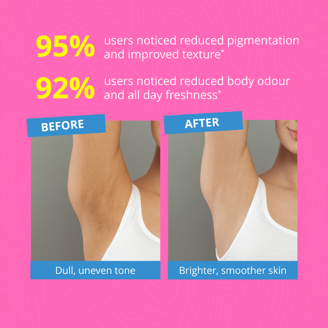 Underarm Roll-On with 3% AHA BHA