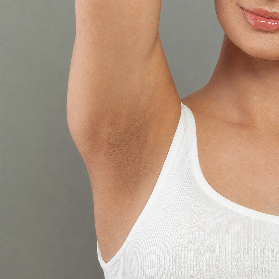 Underarm before using the roll-on